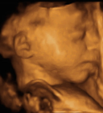 Pregnancy Week image