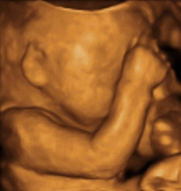 Pregnancy Week image