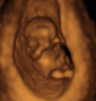 Pregnancy Week image