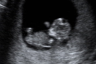 Pregnancy Week image