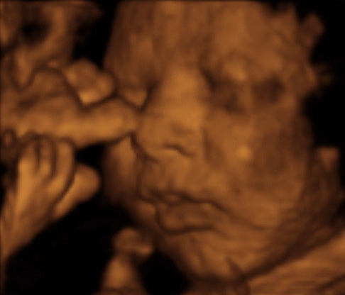 Pregnancy Week image