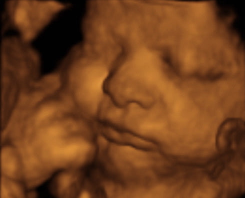 Pregnancy Week image
