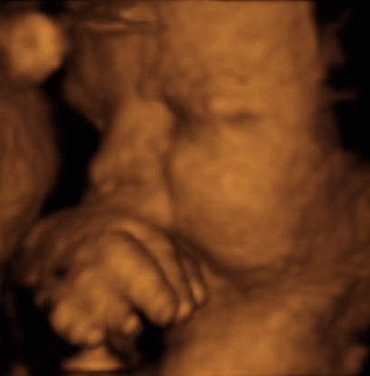 Pregnancy Week image