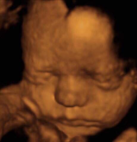 Pregnancy Week image