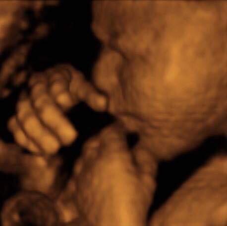 Pregnancy Week image
