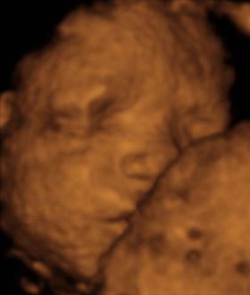 Pregnancy Week image