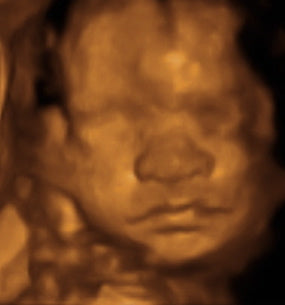 Pregnancy Week image