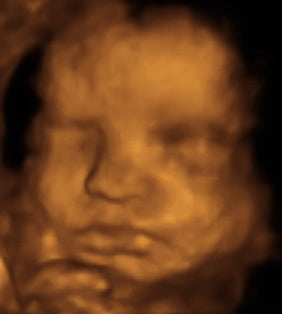 Pregnancy Week image