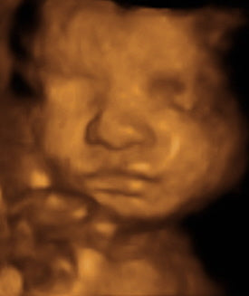 Pregnancy Week image