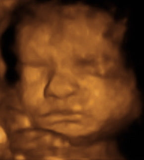 Pregnancy Week image