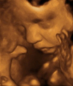 Pregnancy Week image