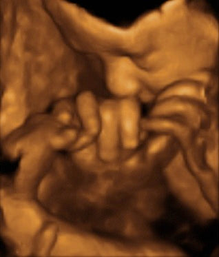 Pregnancy Week image