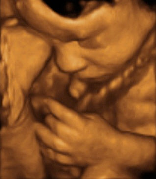 Pregnancy Week image