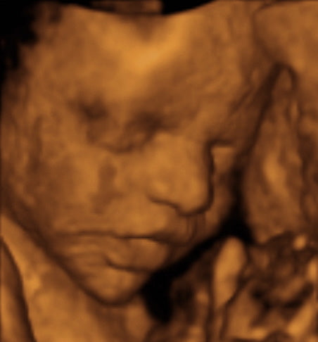 Pregnancy Week image
