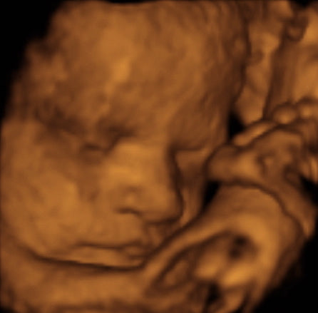 Pregnancy Week image