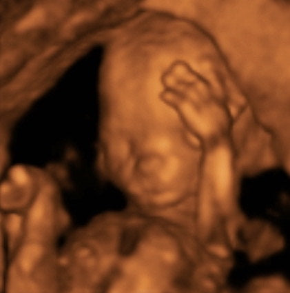 Pregnancy Week image