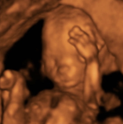 Pregnancy Week image