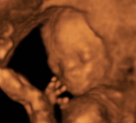 Pregnancy Week image