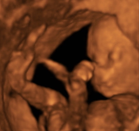 Pregnancy Week image