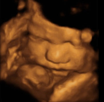 Pregnancy Week image