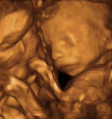 Pregnancy Week image