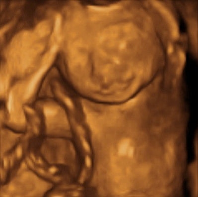 Pregnancy Week image
