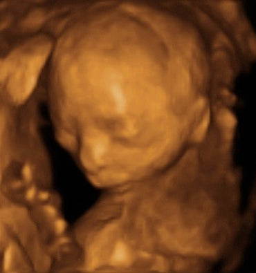 Pregnancy Week image