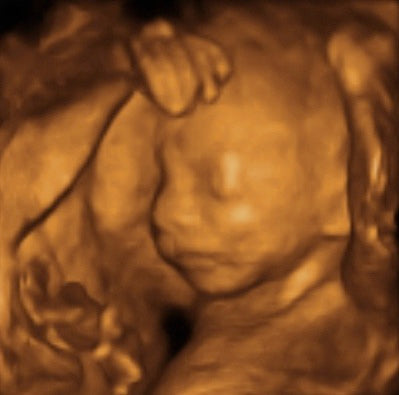 Pregnancy Week image