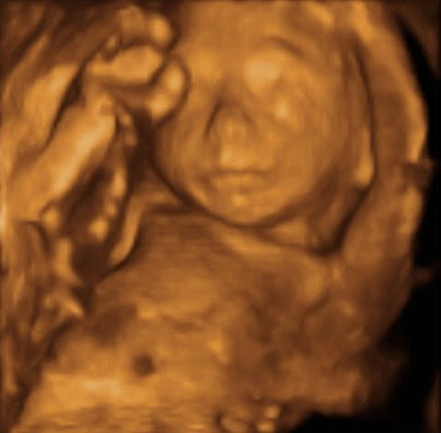 Pregnancy Week image