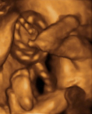 Pregnancy Week image