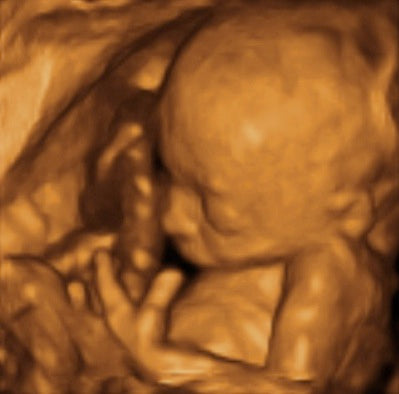 Pregnancy Week image
