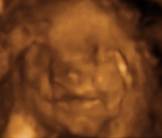 Pregnancy Week image