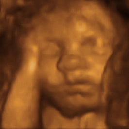 Pregnancy Week image