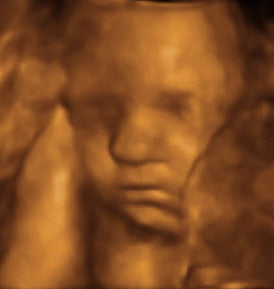 Pregnancy Week image