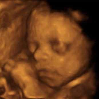 Pregnancy Week image
