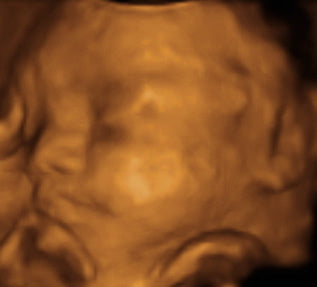 Pregnancy Week image