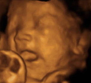 Pregnancy Week image