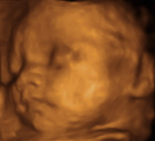 Pregnancy Week image