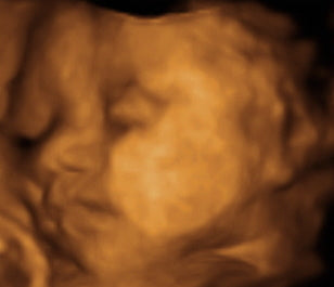 Pregnancy Week image