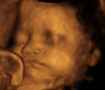 Pregnancy Week image