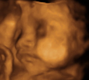 Pregnancy Week image