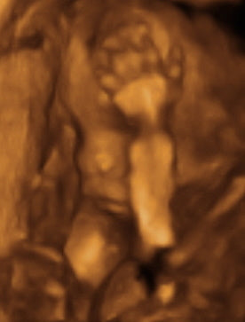 Pregnancy Week image