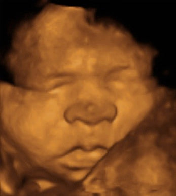Pregnancy Week image