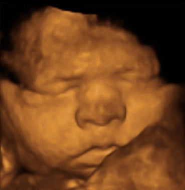 Pregnancy Week image