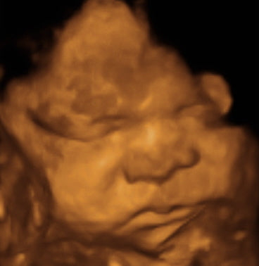 Pregnancy Week image