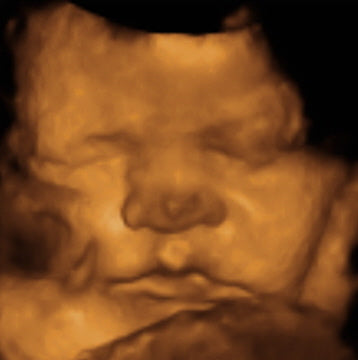 Pregnancy Week image