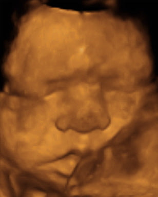 Pregnancy Week image