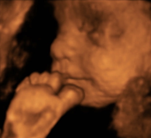 Pregnancy Week image