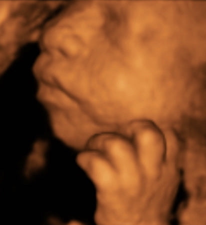 Pregnancy Week image