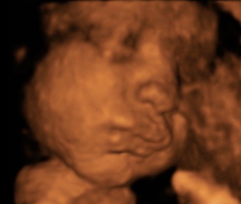 Pregnancy Week image